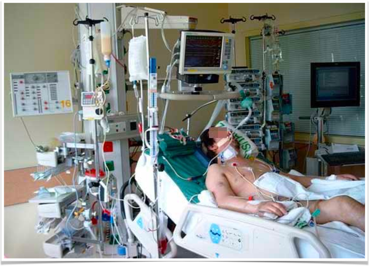 Patient in the ICU